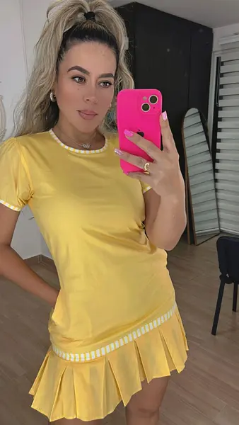 Vestido Amarilla Pollito – Estilo Fresco Y Elegante
